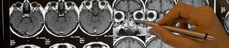 Brain Scans at at Southern California Movement Disorder Specialists